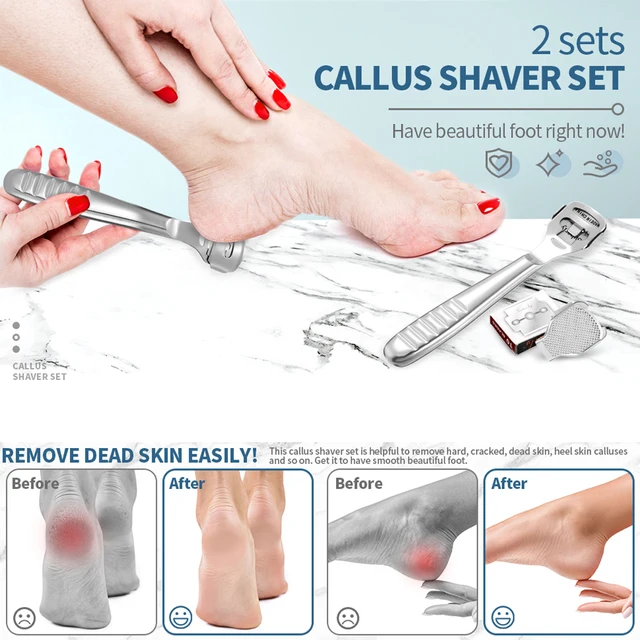 NOGIS Callus Remover for Feet, Foot Callus Shaver Heel Hard Skin Remover  for Hand Feet Pedicure Razor Tool Shavers with Stainless Steel Handle 10