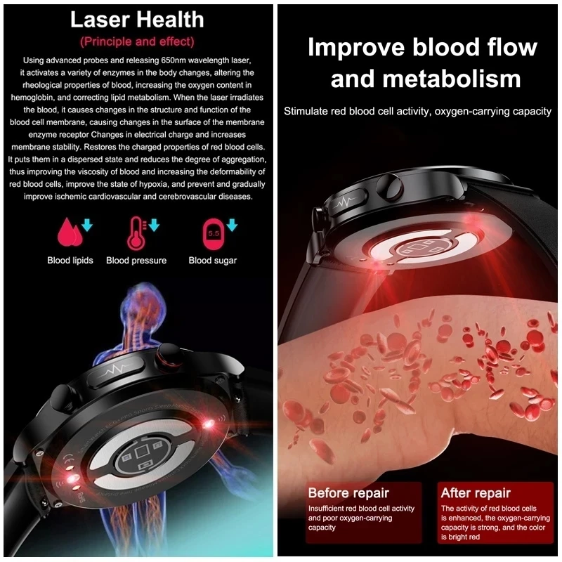 ο Smartwatch     ü ǰ ͸ Ʈ ġ   ð 2023