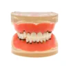 Dental Teeth Model  Dentist Teaching Model Demonstration Periodontal Disease Pathological For Patient Education Demo M4017 2