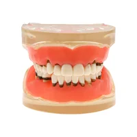 Dental Teeth Model  Dentist Teaching Model Demonstration Periodontal Disease Pathological For Patient Education Demo M4017 2