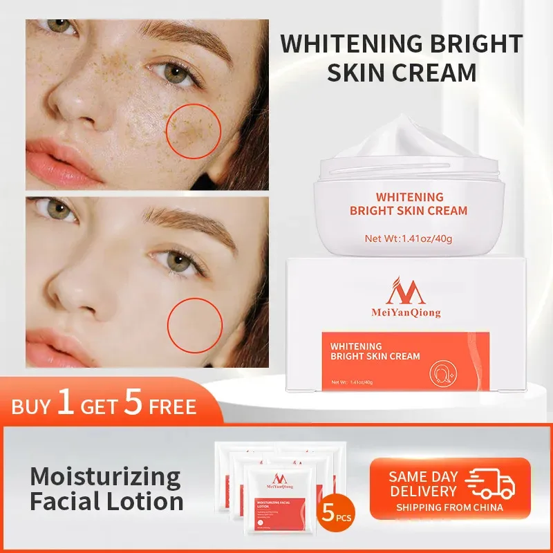 Moisturiser Face Whitening Freckle Cream Remove Acne Spots Melanin Dark Spots Face Lift Firming Face Skin Care Bright Skin Cream