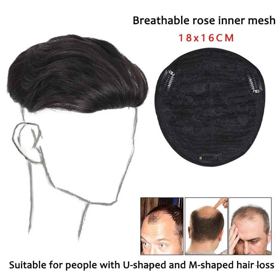 Synthetic Short Hair Wigs for Men Handsome Bald Forehead Replacement