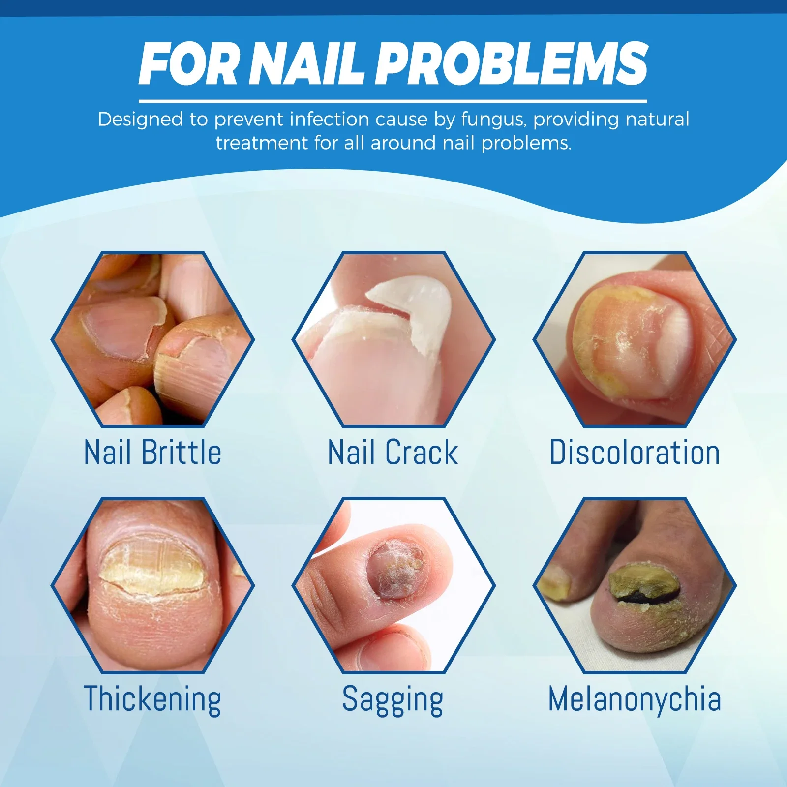 Nail fungus remover Fungal Nail Laser Device Repair Fast Nails Fungus Onychomycosis