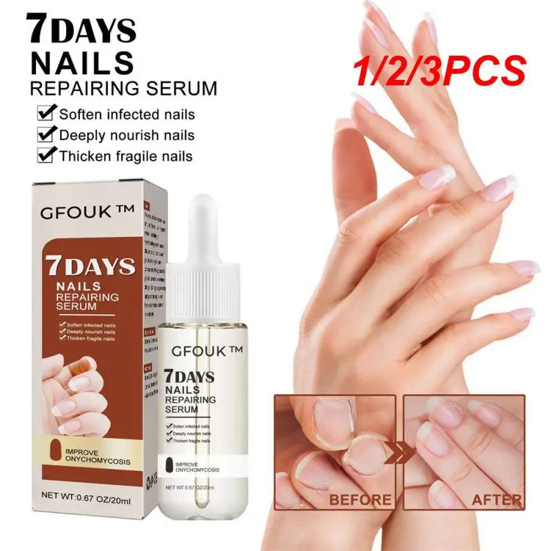 

1/2/3PCS Nail Repair Easy To Carry Skin Care Nursing Liquid No Irritation Gentle Repair Kill Fungi 20ml