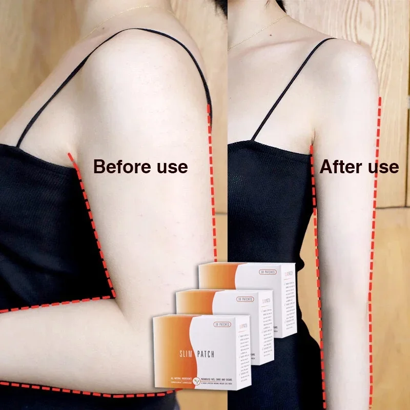 10 DAYS Slimming Patch Detox Weight Loss Sticker Navel Belly Stick Quick Slim Patch Fat Burning Thin Body Belly Fat Burner weight loss products