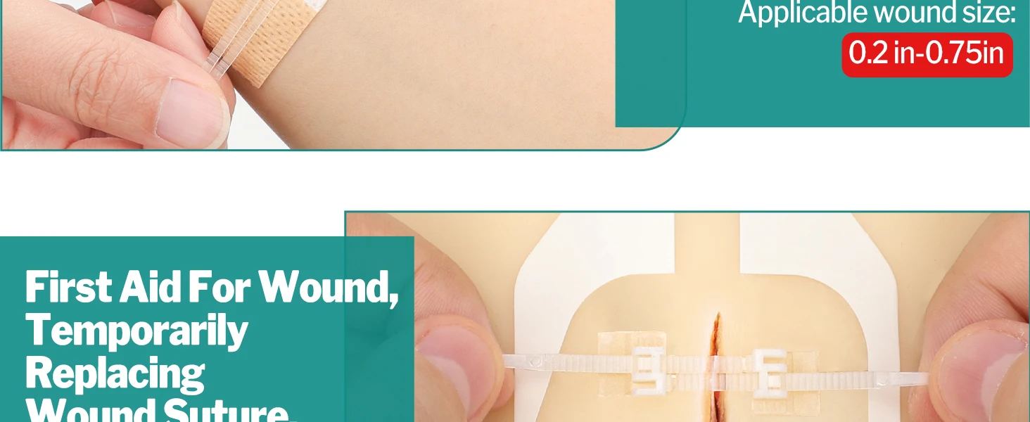 Sanke Rescue Wound Closure Strips - Detail Image 2