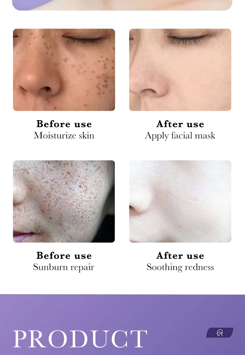 Niacinamide Whitening Freckle Mask Image 18