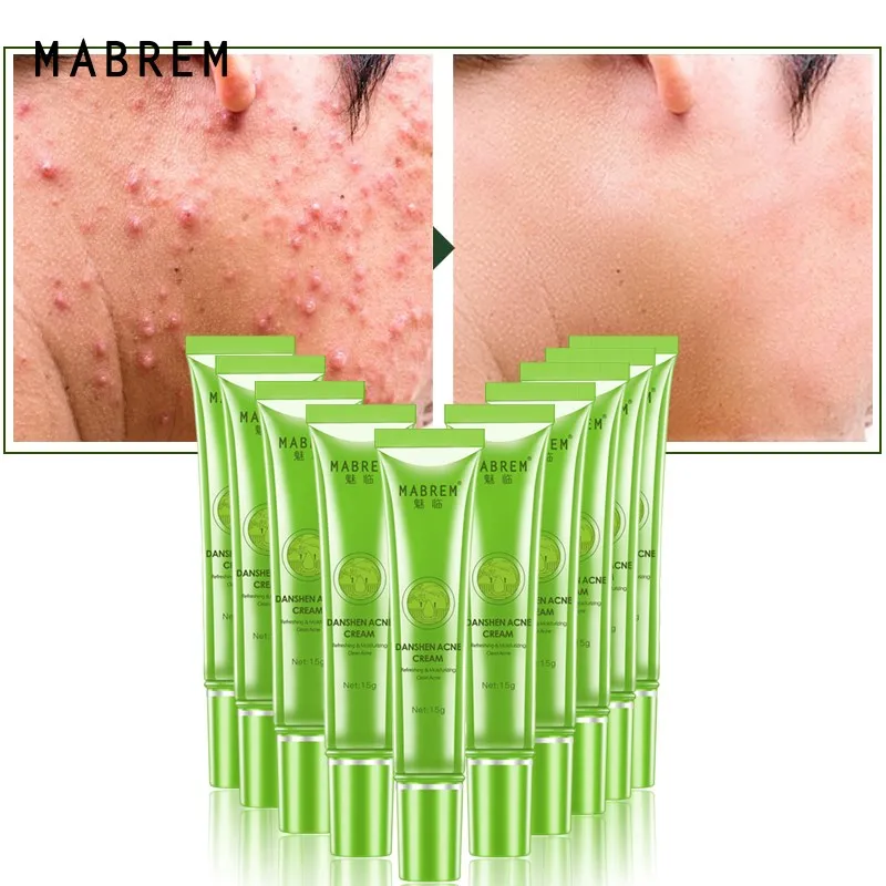 Mabrem Danshen Acne Cream Removing Acne Shrinking Pores Improving Dry
