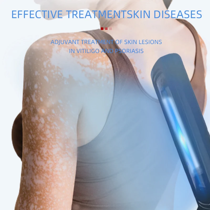 Home Use Psoriasis Equipment 308nm UV Lamps Phototherapy Medical Device UvbTreatment Light For Vitiligo 4