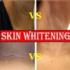 Whitening Cream Private Parts Underarm Bleaching Serum Whiten Butt Knee Brighten Inner Thigh Intimate Parts Dark Remove Melanin 3