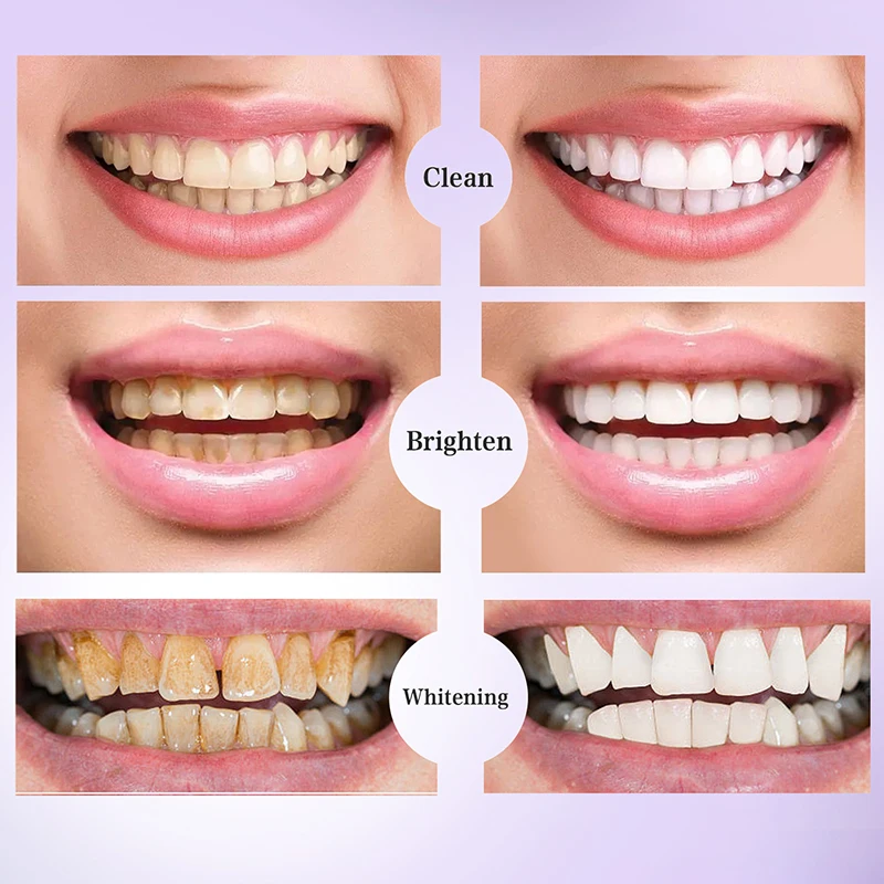 V34 Pro Whitening Toothpaste Removal Plaque Stain Purple Corrector Teeth Enamel Care Easy Reduce Yellowing Oral Clean Care teeth whitening essence teeth whitening product