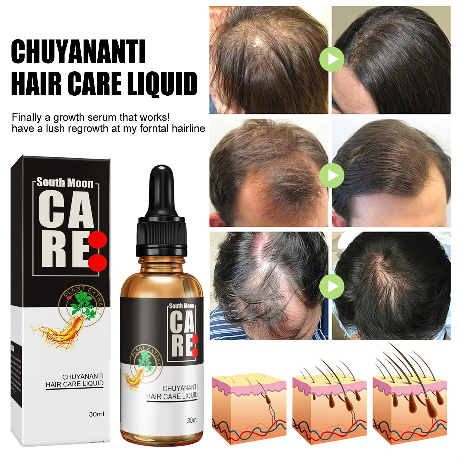 Description Picture 6 of itemHair growth solution for preventing hair loss, fixing and densifying hair, magical hairline, hair growth and growth