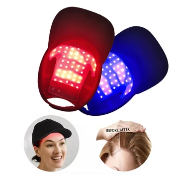 Terapia della luce rossa per la crescita rapida dei capelli Dispositivo per terapia della luce rossa e a infrarossi per il trattamento della perdita dei capelli con ricarica USB Anti-capelli
