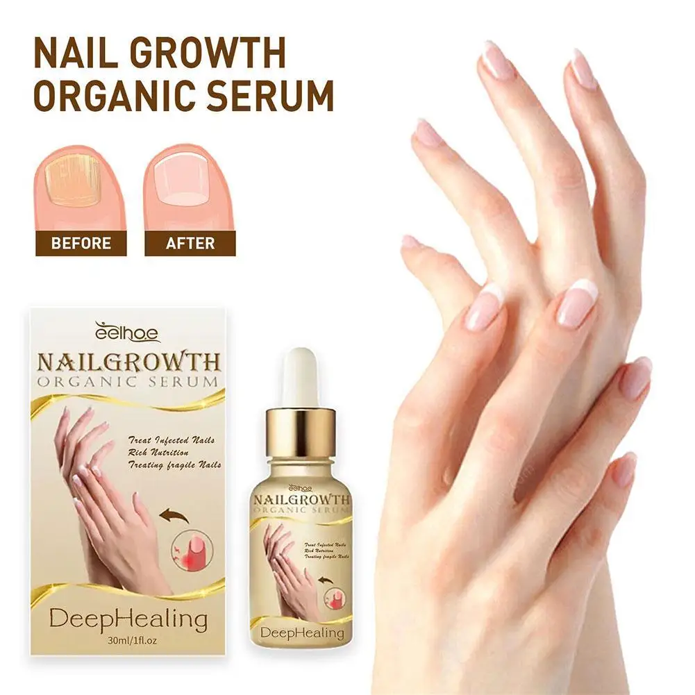 Nail Treatment Essence Serum Care Hand And Foot Care Nail Fungus