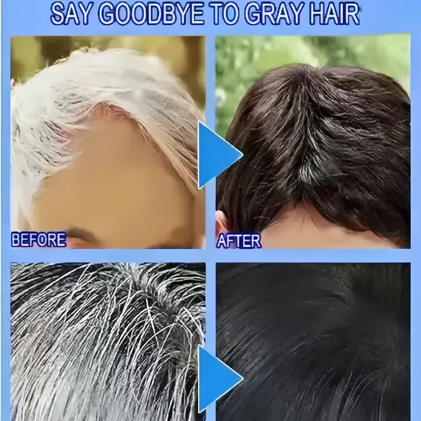 Hair Coloring Product White hair killer remove gray hair and restore natural color in 7 days hair coloring product