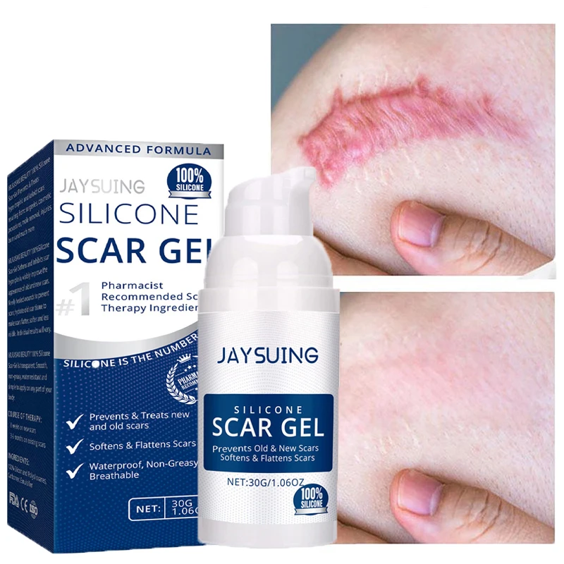 RetinolScarRemovalGelCreamBurnAcneSurgicalScarCesareanScar