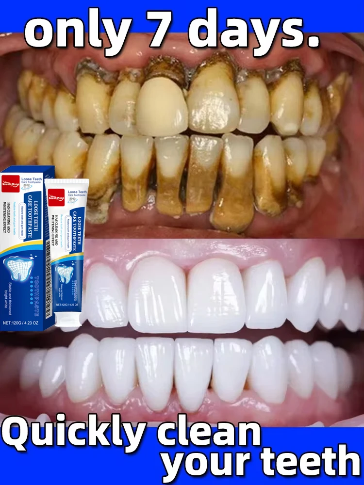 Teeth Whitening Toothpaste Dental Calculus Remover Plaque Stains Cleaning Oral Hygiene Prevent Periodontitis Dental Tools Care