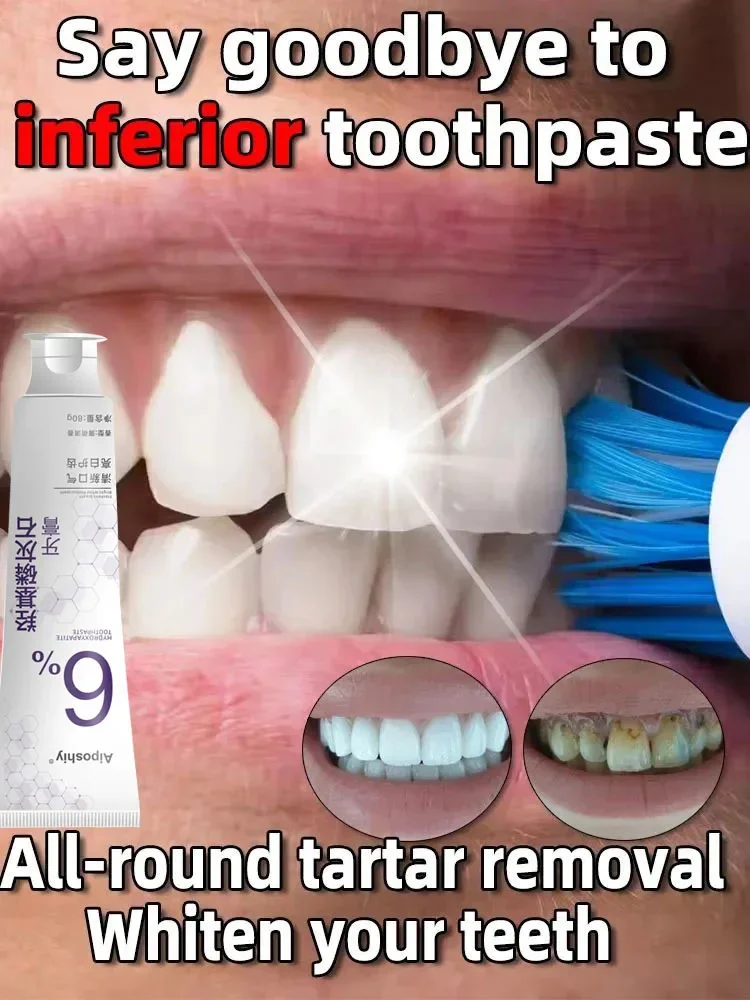 Dental Calculus Remover Teeth Whitening Product Mouth Odor Removal Bad Breath Preventing Periodontitis