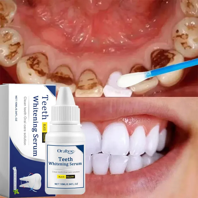 Teeth Whitening Serum Remove Plaque Stains Toothpaste Deep Cleaning Dental Oral Hygiene Tools Fresh Breath Tooth Care Products teeth whitening product teeth whitening essence