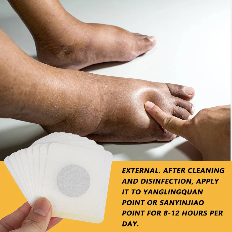 Edema Remove Patch Swelling Leg Foot Thigh Body Treatment Antiedematous Acupoint Massage Pain Relief Medical Plaster 10/30Pcs