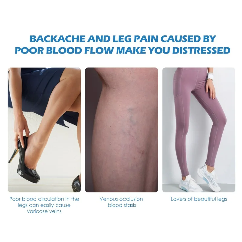 Spray for Varicose Veins Effective Varicose Vein Relief Cream Relieve Leg Vasculitis Phlebitis Spider Pain Swelling Treatment