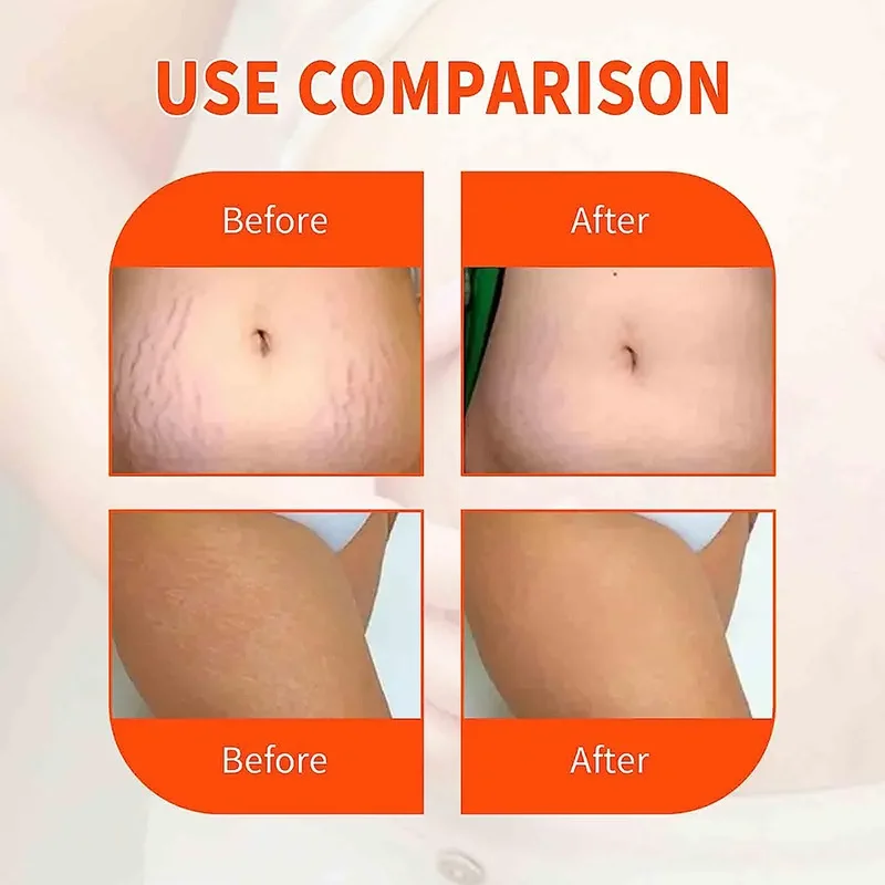 Рисунок 2 - Эфирное масло для ухода за кожей тела