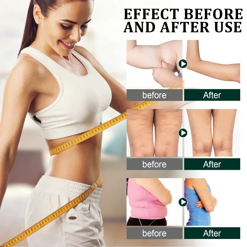 Slimming Essence Oil Fat Burning Belly Loss Fat Lose Weight Slim Down tighten abdominal thigh Weight Lose Schap Essential Oils | slimming patch,slimming cream gel