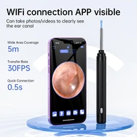 Wireless Vision Silicone Ear Scoop Endoscope Ear Extraction HD Camera Earwax Remover Otoscope Cleaning Tool With Recharge Base 2