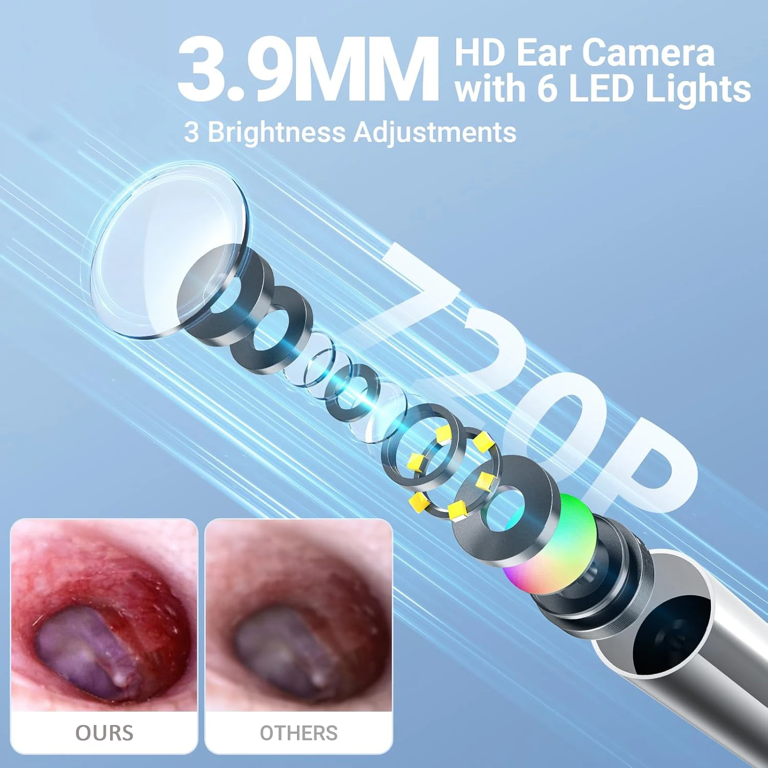 Otoscopio digitale SA160 Schermo IPS Otoscopio video intelligente HD con luce, otoscopio per orecchio con fotocamera per rimozione cerume - immagine 3