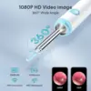 Dr.isla HD Smart Visual Ear Sticks Endoscope High Precision Earpick Camera Otoscope Health Care Ear Cleaner Ear Wax Remover 2