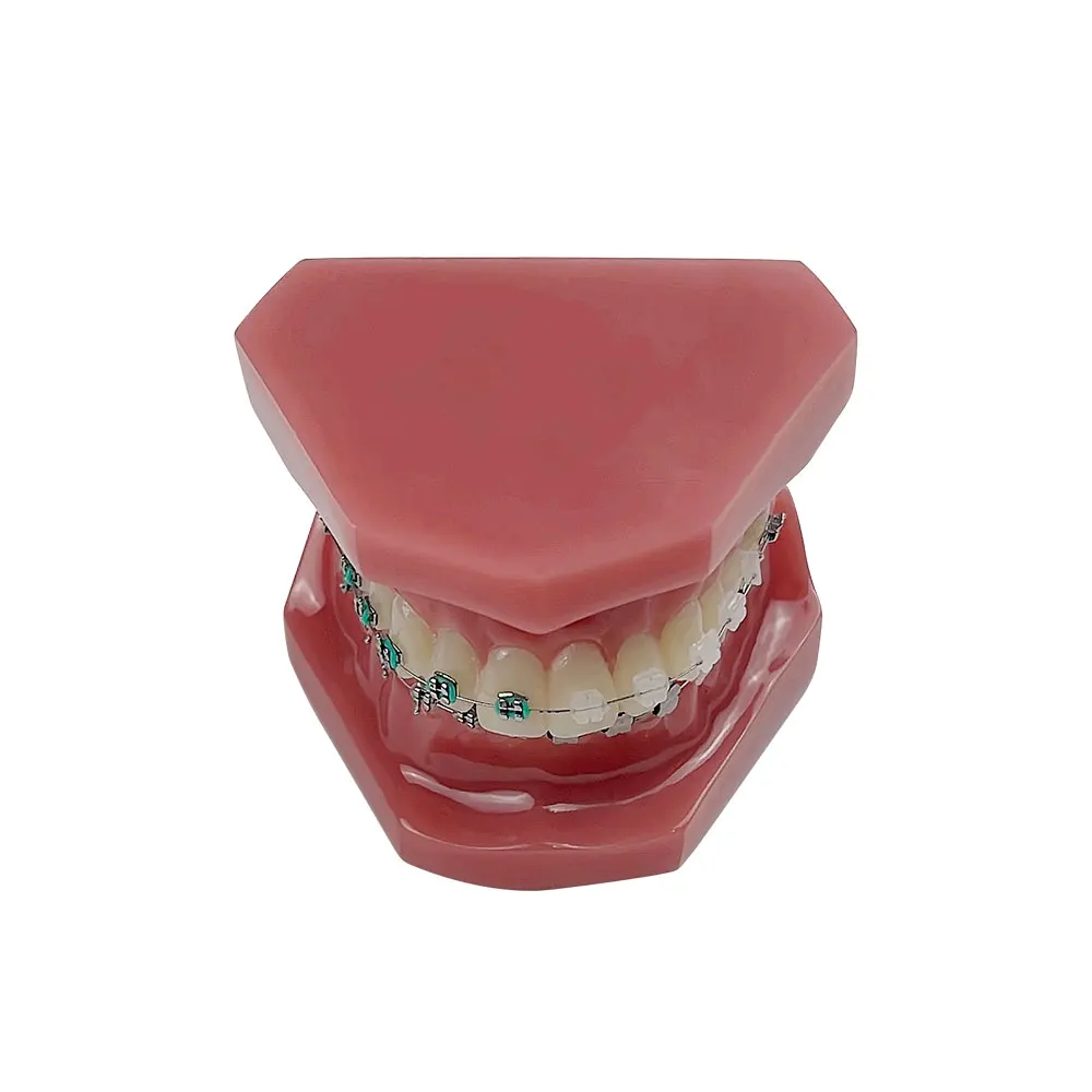 Modelo ortodôntico dental modelo oral meia cerâmica