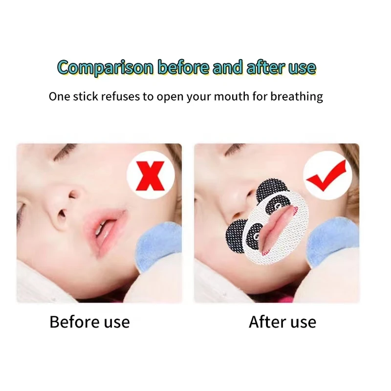 Description Picture 5 of item30PCS Kids Cartoon Anti-Snoring Stickers Sleeping Closed-mouth Stickers Breathing Correction Patch Shut Up Patch Orthosis Tape