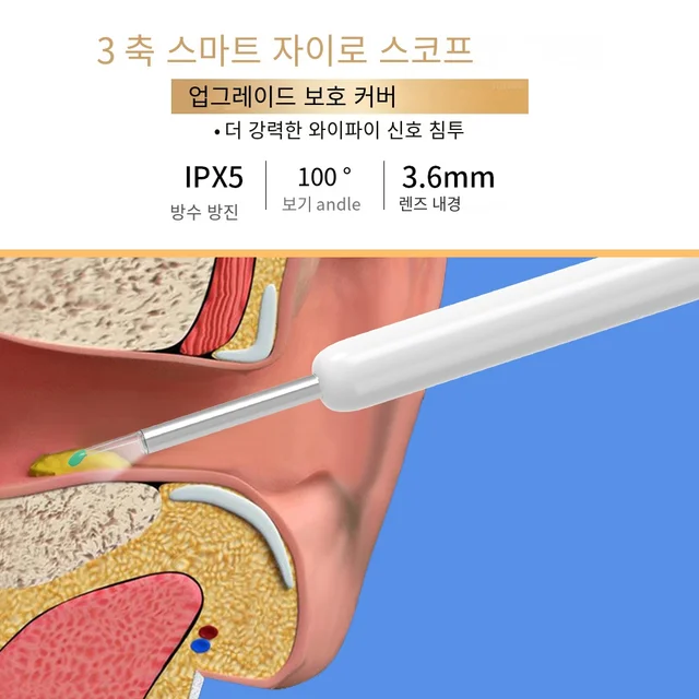 안전하고 효율적인 귀 청소를 위한 다목적 스마트 귀 청소 키트