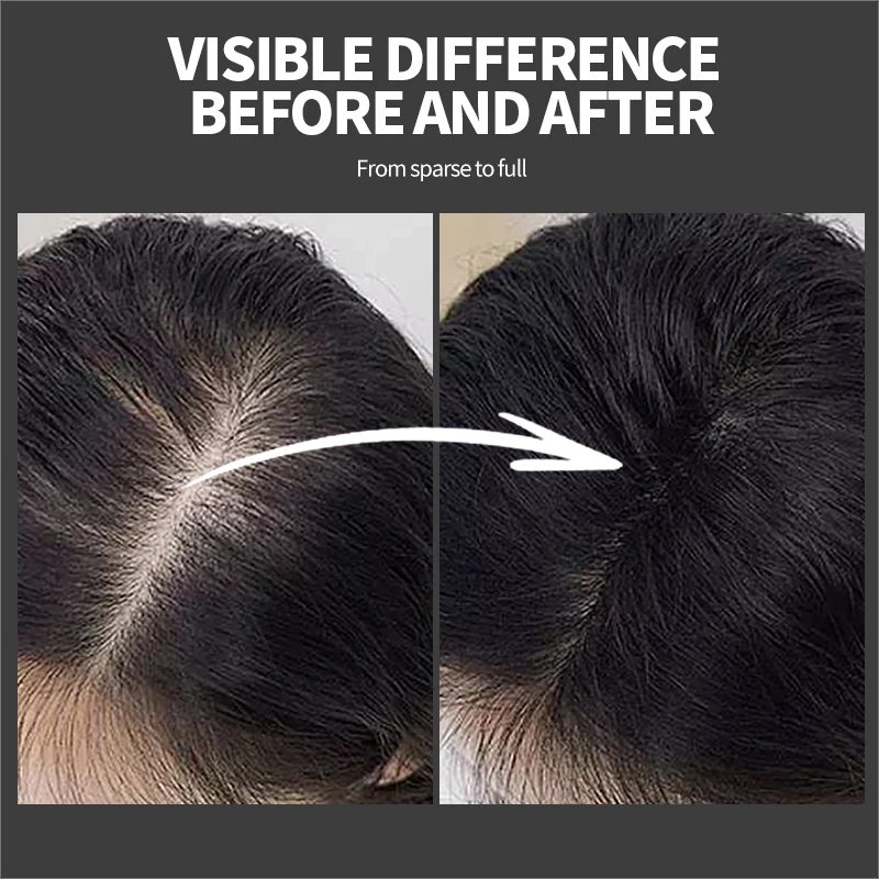 25g Hair Fibers Regrowth Powders Hair Building Fiber Natural Keratin Styling Powder Optimizer Dense Care Regrowth Fiber