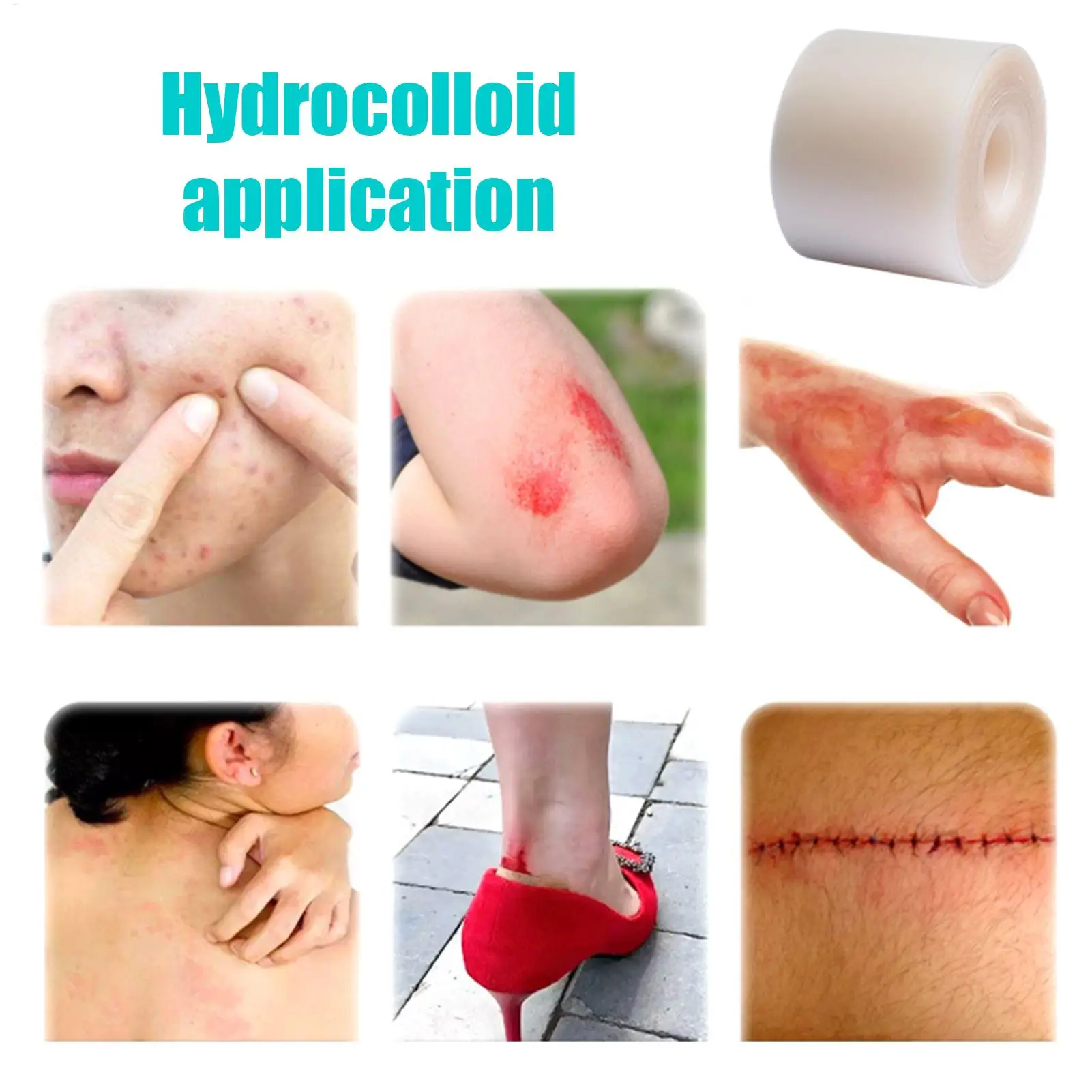 Hydrocolloid Roll For Wound Care Hydrocolloid Patch Bandages With Self-Adhesive Bed Sore Bandages Highly Absorbent For Burn