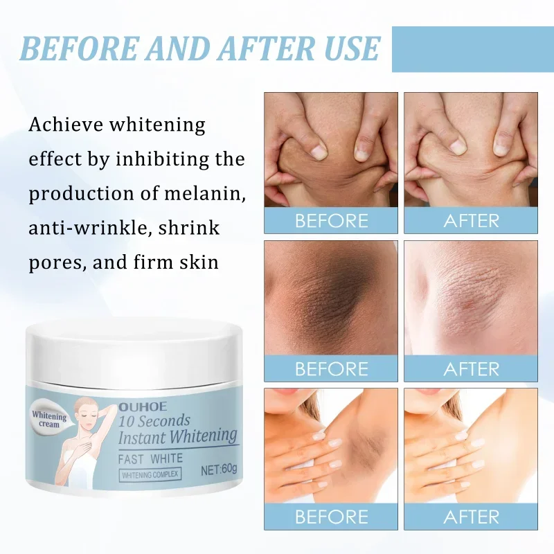 Under arm Whitening Cream for women Underarm Bleaching Whiten Elbow Knee Brighten Intimate Parts Dark Spots Remove Melanin care whitening cream