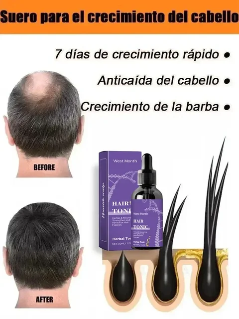 Get more hair, say goodbye to baldness and thick hair.