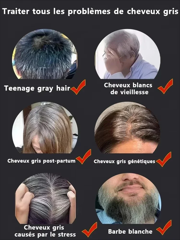 Cabelo branco, resolvendo o problema do cabelo branco, restaurando a cor natural do cabelo