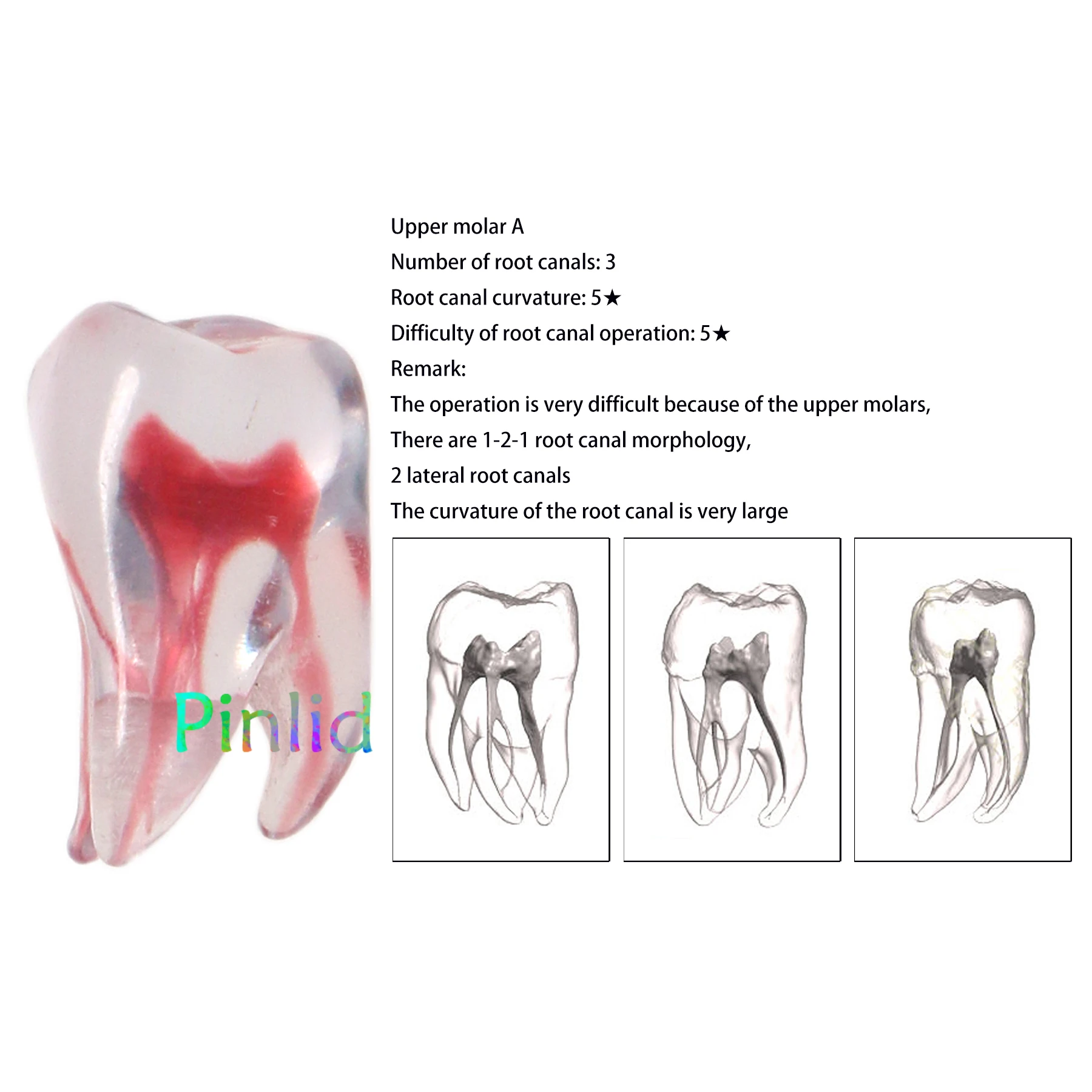 LKYLVEE Modello Dentale In Resina Con Base In Gesso, Modello Per La Preparazione Dei Denti A 28 Denti, Modello Dentale In Resina Per Insegnamento Di Studio - Foto 7