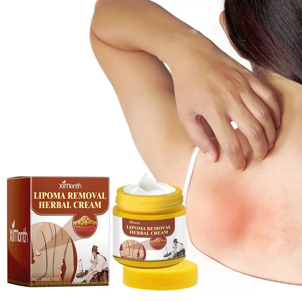 1pc Lipoma Removal Herbal Cream Body Cream Dissolving Fat Easy To Use Herbal Lipoma Removal Cream - Image 3