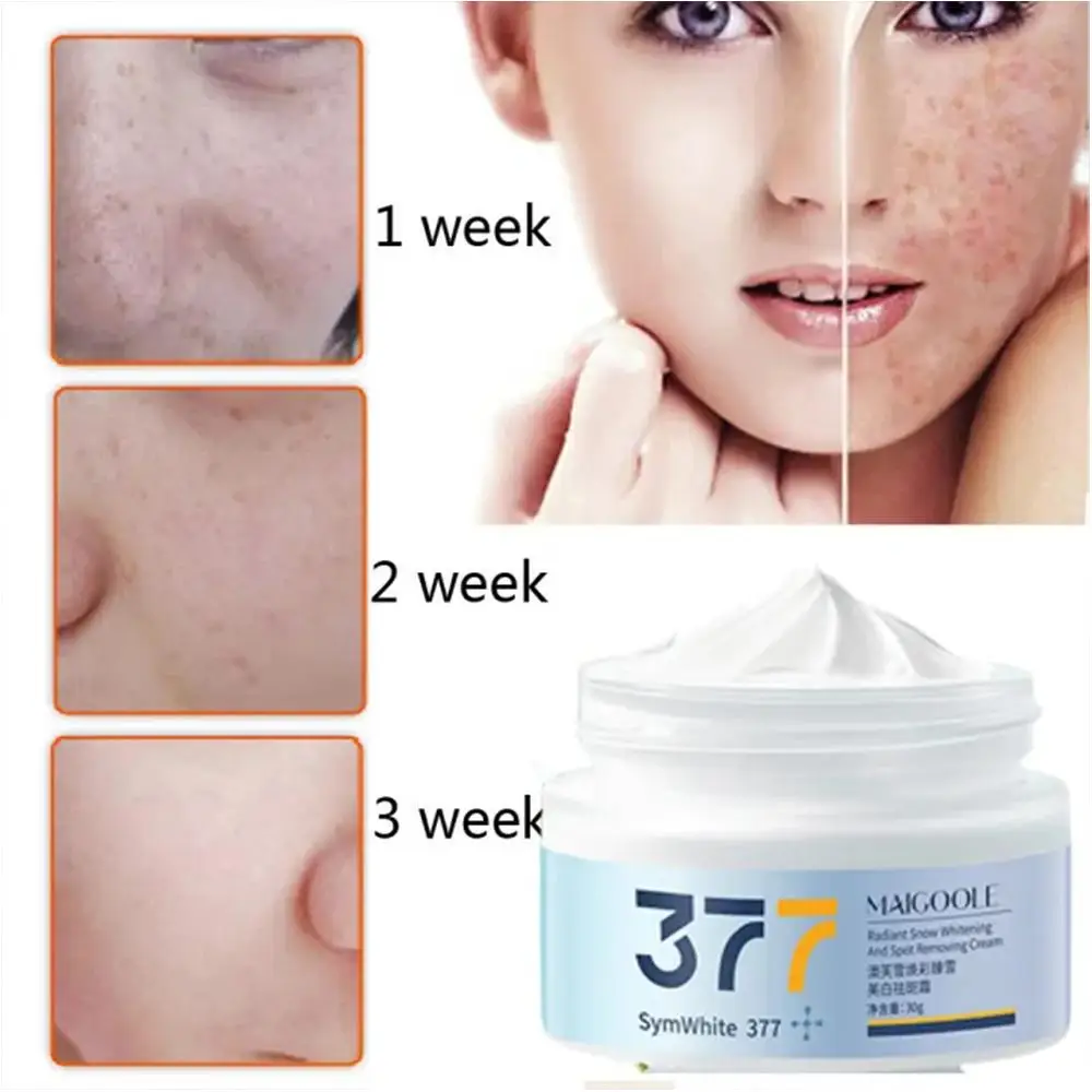 

377 Effective Whitening and Freckle Removing Cream Whitening Fades 30g Moisturizing Spots Care Brightens Facial Cream Skin S8I8