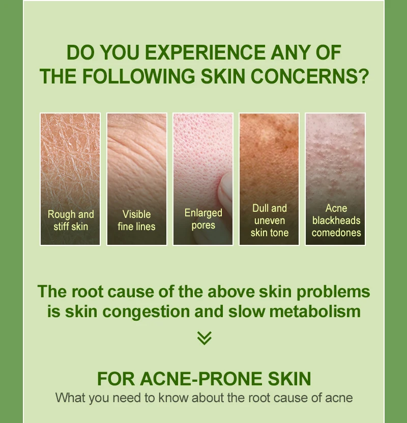 Description Picture 4 of itemSalicylic Acid Exfoliating Pads Oil Control Blackhead Removal Moisturizing Facial Masks Smoothing Lifting Firming Skin Care