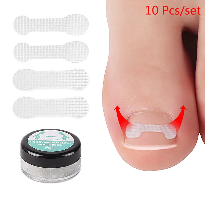 

2021 New 10Pcs Ingrown Toe Nail Correction Sticker Patch Paronychia Correction File Acronyx Wire Corrector Foot Care Treatment