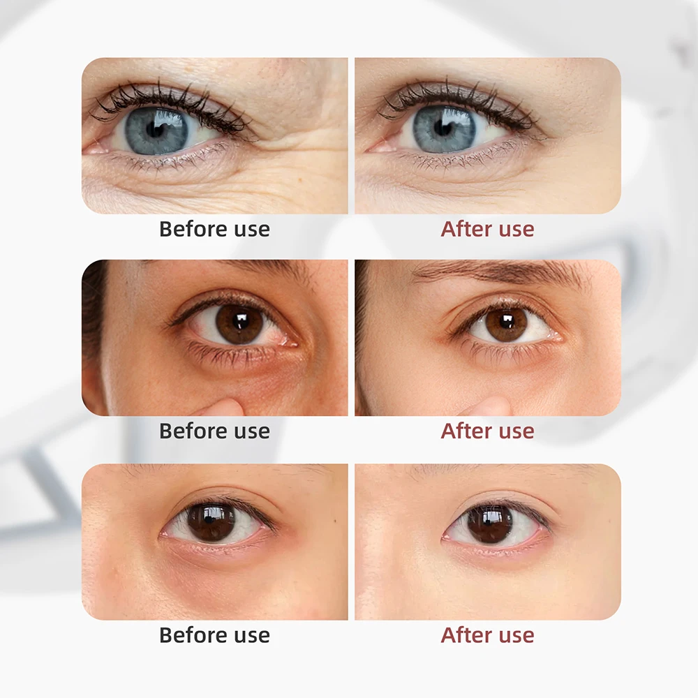 Eye Massager under-eyes Relax Fatigue Eye Glasses Lighten Dark Circles Smooth Eye Fine Line belleza Eye Care