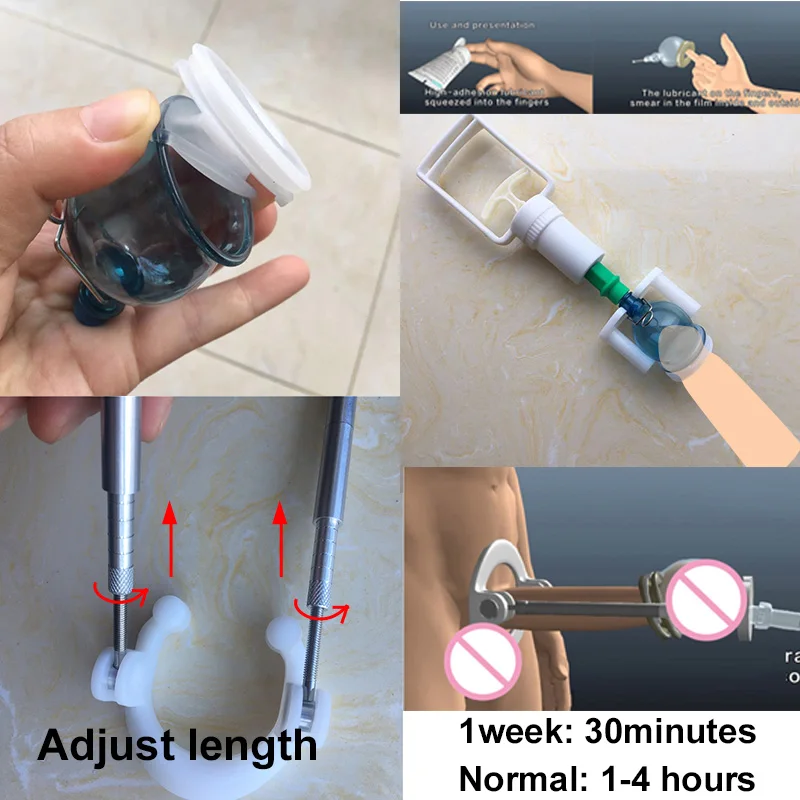 Penis Edge Stretcher Extender Strap Male Enlargement Dick Enlargers Penile Physical Exerciser Pump Cup Erection Medical Device