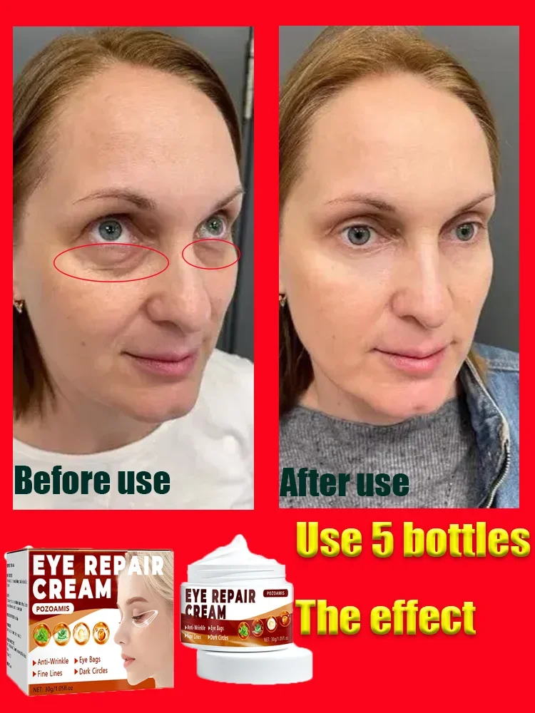 

Антивозрастной коллагеновый крем для глаз от темных кругов и мешков под глазами, средство для ухода за кожей, крем для глаз, уход за кожей для глаз, AliEx