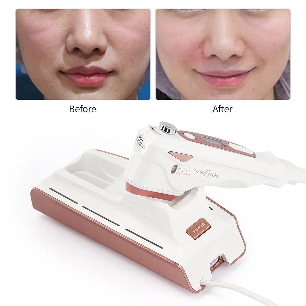 Mini HIFU Ultrasound Therapy Machine High Intensity Focused Beauty Facial Lifting Rejuvenation Firming Skin Anti Aging Wrinkle