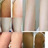 300g/10.58 OZ Curing Keratosis Pilaris Chicken Skin Body Lotion Skin Repair Cream Skin Care Essence Moisturizing And Nourishing 6