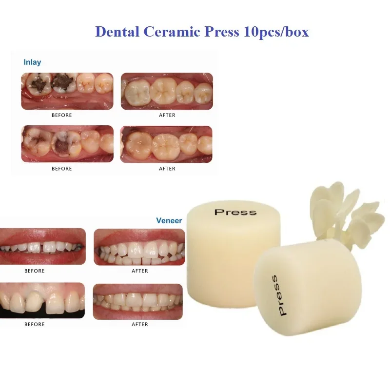 10PCS-CAD-CAM-Dental-Glass-Ceramic-Blocks-Bending-Strength-Veneer-Inlay ...