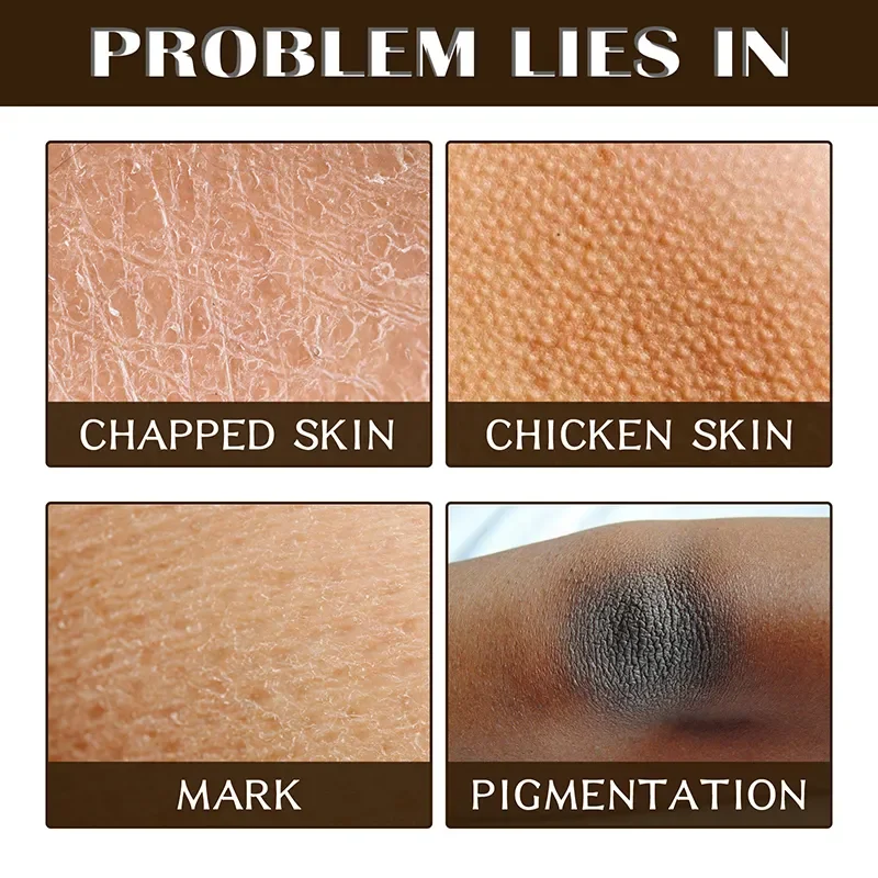 Coffee Body Scrub Cream Exfoliating Bleach Elbow Underarm Knee Melanin Pigmentation Whitening Remove Dead Skin Shower Scrub Care body scrub
